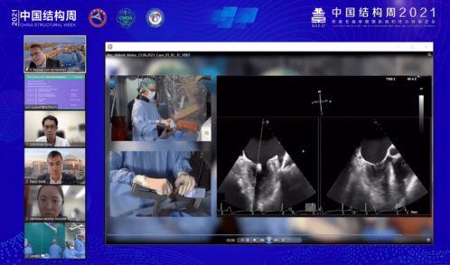 在线人工精彩国产,探索数字时代的文化盛宴